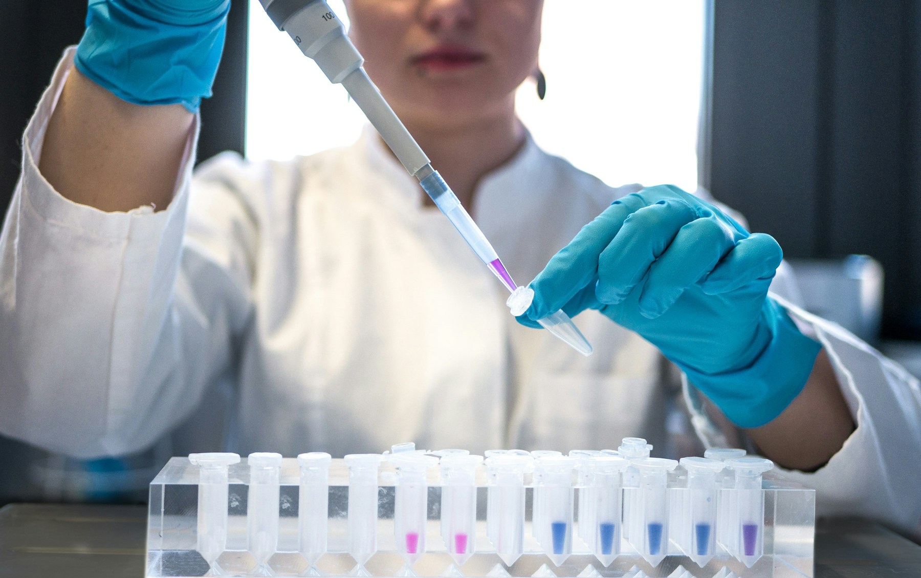 Laboratory scientist using a pipette to prepare an analytical sample